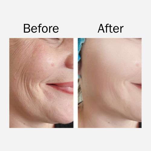Organic Hyaluronic Acid Serum – Hydrating & Plumping Face Serum for Smooth, Glowing Skin, Anti-Aging Moisture Boost, Lightweight & Fast-Absorbing Formula